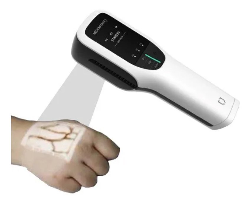 Advanced Vein Finder System