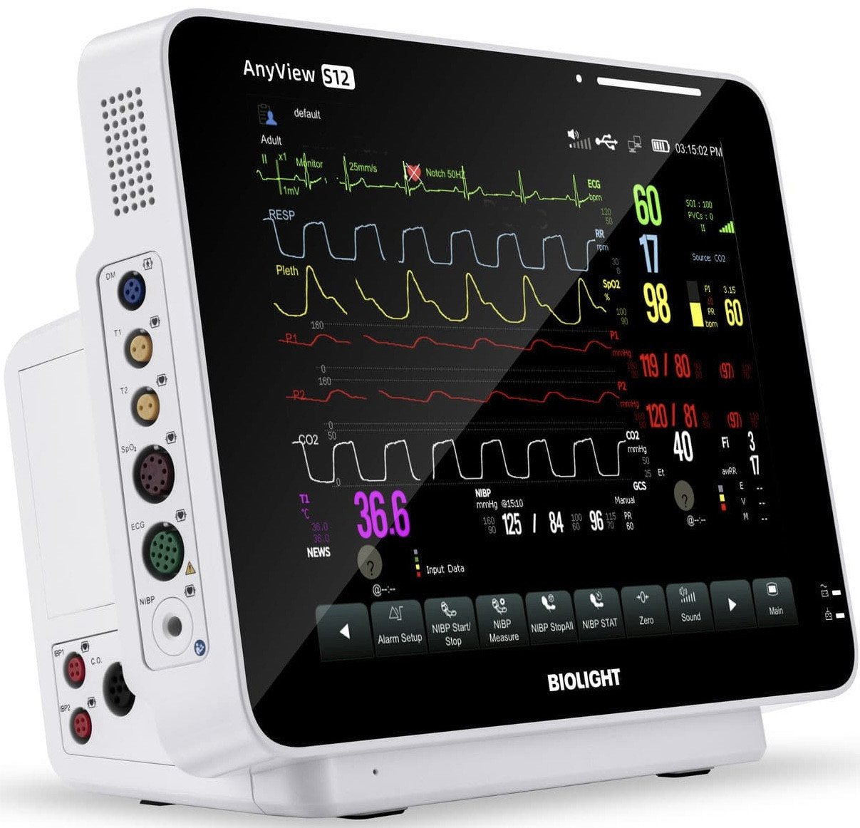 Patient Monitor