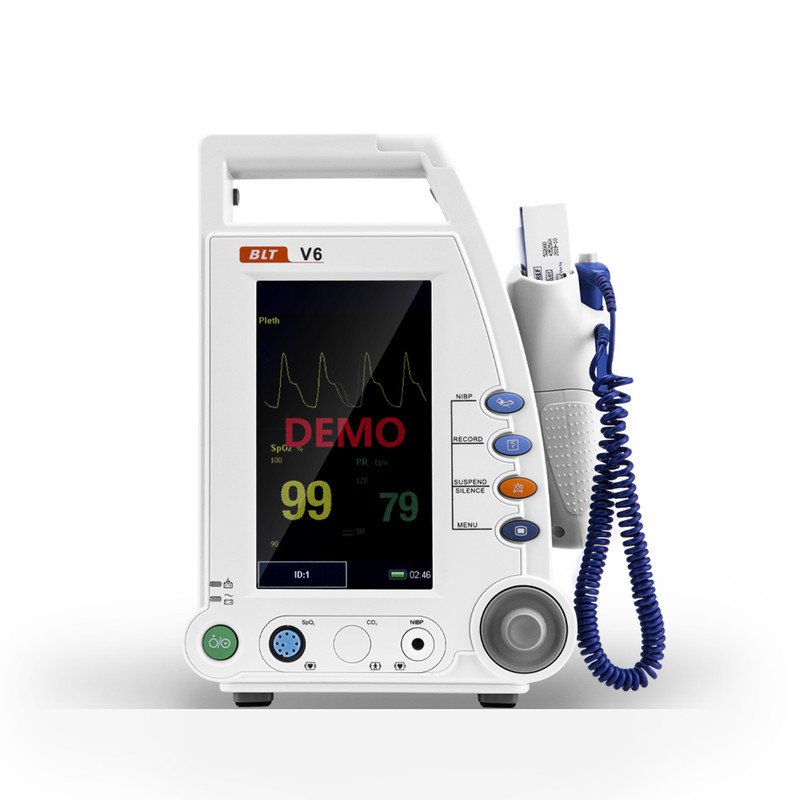 Vital Sign Monitor
