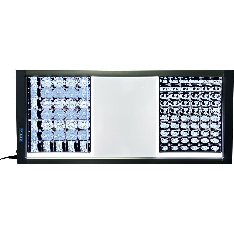 High-Performance X-ray View Box